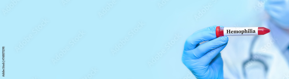 Doctor holding a test blood sample tube with Hemophilia test on the background of medical test tubes with analyzes. Banner Doctor holding a test blood sample tube with Hemophilia test on the background of medical test tubes with analyzes. Banner