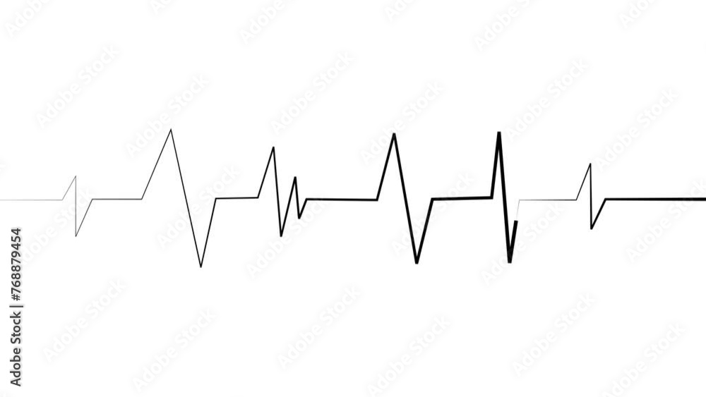 Heartbeat line. Pulse trace. EKG and Cardio symbol. Healthy and Medical concept animation Heartbeat line. Pulse trace. EKG and Cardio symbol. Healthy and Medical concept animation