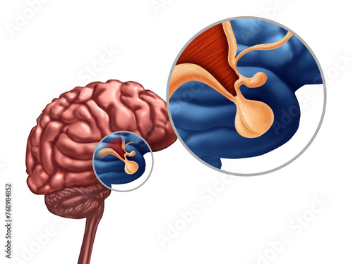 Pituitary Gland or Hypothalamus or hypophysis cerebri concept as the endocrine system symbol related to growth hormone as part of the human anatomy.