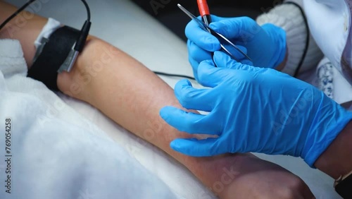 a master performs an electrodepilation procedure on a girl's arm  photo