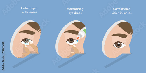 3D Isometric Flat Vector Illustration of Moisturizing Eye Drops, Using of Artificial Tears