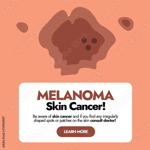 Melanoma skin cancer cell. Skin disease, infection, illness, pimple, spot. Skin problems awareness social media post. Melanoma awareness banner for guiding people. 