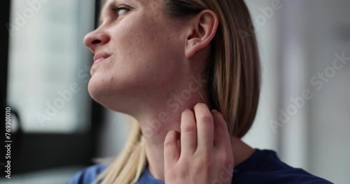 Woman scratches neck suffering from eczema disease photo