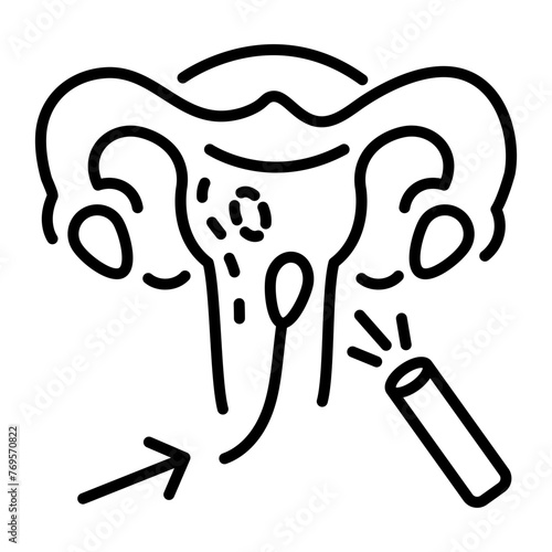 Hysteroscopy line icon is up for premium use 