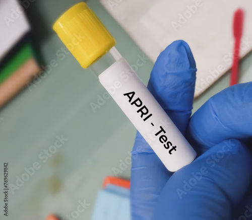 Blood sample for APRI (AST to Platelet Ratio Index) test, liver disease. photo
