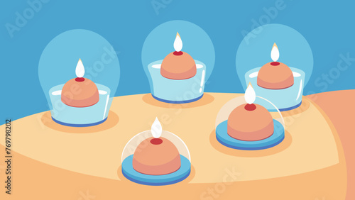  A closeup of a cupping therapy session showing small glass cups p on the skin creating a suction effect with the help of heat.