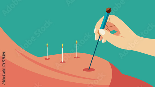  A macro shot of an acupuncture needle being inserted into the skin showcasing the precision and gentle technique involved in the process.