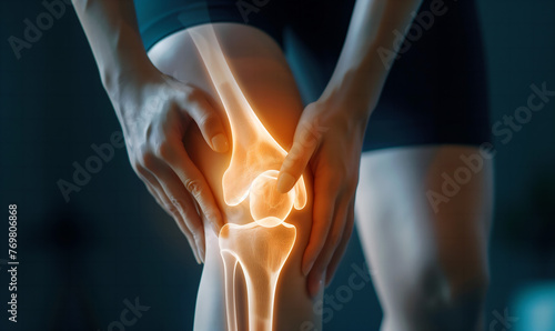 Suffering from knee pain x-ray concept, medical treatment, rehabilitation and injury concept