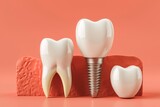 Anatomy of healthy teeth and tooth dental implant. ai generative