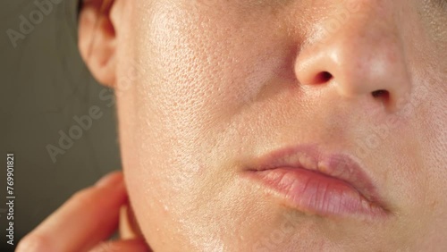 Problem skin with dilated and enlarged pores. Close-up of a woman face. Oily skin. oily shine photo