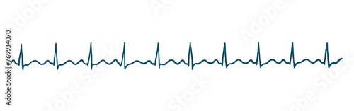 Ecg image shows normal sinüs rhythm