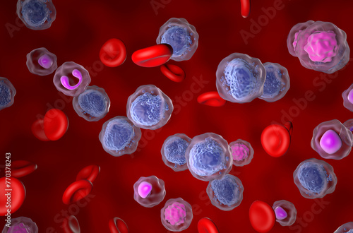 Acute myeloid leukaemia (AML) - isometric view 3d illustration