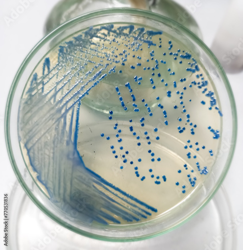 Growing Enterobacter spp bacteria in chromogenic agar medium in microbiology lab. Micro-organisms Enterobacter grow in urine samples.