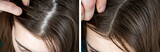 Close up of woman with hair loss problem. Before and after treatment.
