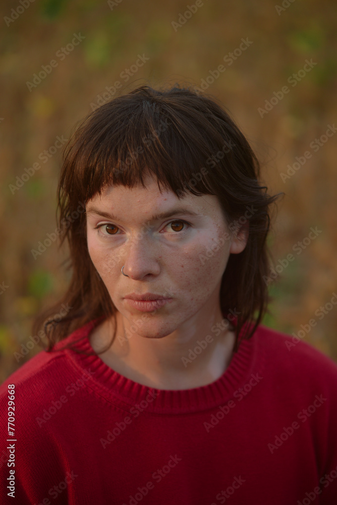 A beautiful woman with vitiligo skin A beautiful woman with vitiligo skin