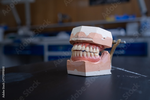 a denture model on a laboratory table with some working utensils. It is the upper and lower jaw. In the background you can see a laboratory