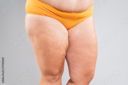 Overweight thighs, woman with fat hips and legs, obesity female body with cellulite on gray background