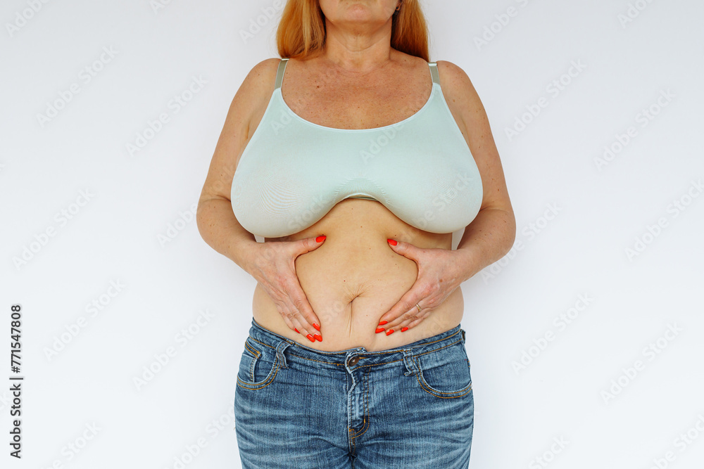 Overweight woman showing fat belly - obrazy, fototapety, plakaty 