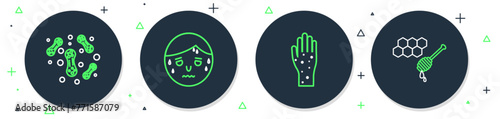 Set line Man with excessive sweating, Hand psoriasis or eczema, Bacteria and Honeycomb honey dipper icon. Vector