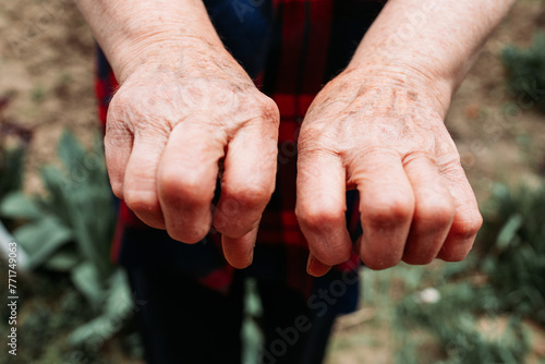 Elderly woman holding hands in a fist