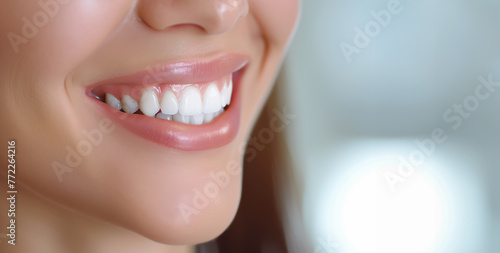 White healthy teeth  close-up. A woman s smile. Dentistry concept banner. Place for signature.