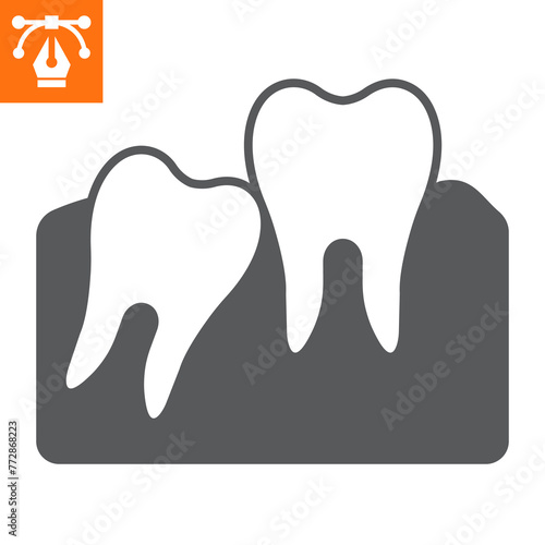 Impacted wisdom tooth solid icon, glyph style icon for web site or mobile app, dentistry and medicine, impacted molar vector icon, simple vector illustration, vector graphics.