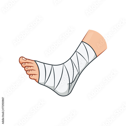 The foot is bandaged with a tight bandage vector isolated on white background.