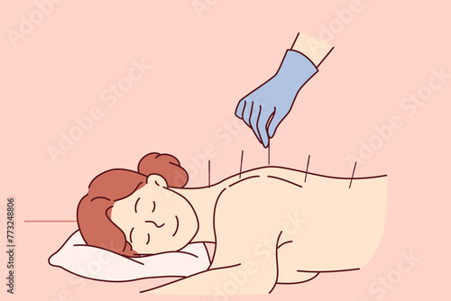 Acupuncture procedure from traditional chinese medicine for woman lying at reception in SPA center. Process of acupuncture and needle therapy allows you to get rid of pain in spine after injury