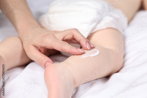 Woman applying body cream onto baby`s leg on bed, closeup