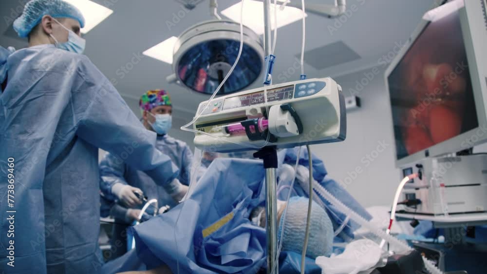 Professional surgeons in the operating room. Instrument for laparoscopic surgery. A surgeon performs laparoscopic gastric surgery in the operating room. Professional surgeons in the operating room. Instrument for laparoscopic surgery. A surgeon performs laparoscopic gastric surgery in the operating room.