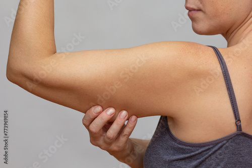 Cropped woman body showing arm with sagging skin on grey background photo