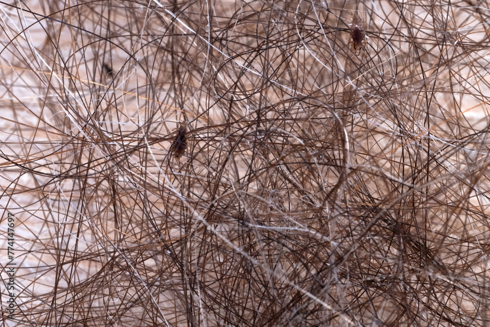 Obraz premium Close-up of head lice and nits on brown human hair, Anoplura, Medical conditions, Personal hygiene, Children's health, Parasites, Pediculosis