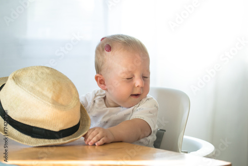 Baby boy with Hemangioma on head sitting in high chair ready for eating photo