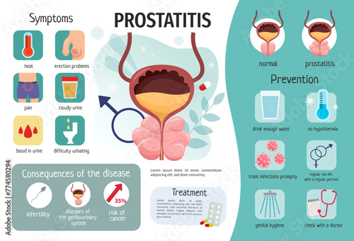 Vector medical poster Prostatitis. Infographics of diseases of the genitourinary system.
