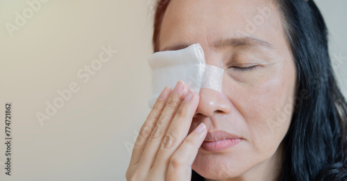 Close-up of an adult Asain woman having a gauze bandage on his right eye over light beige background. photo