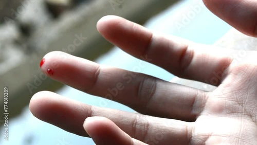 Photo of a finger cut, cut by a knife, bleeding fresh red blood