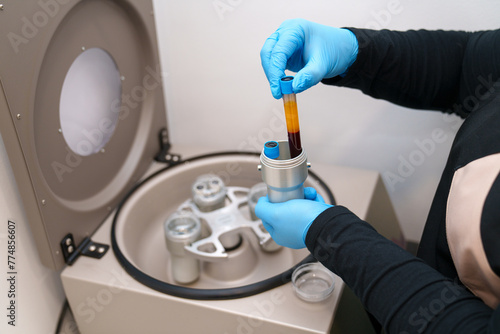 Centrifuge loading with blood sample for PRP treatment. © Koldo_Studio