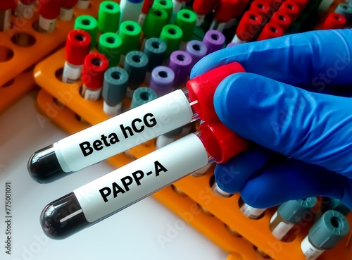 Blood sample for PAPP-A and Free B-HCG test for Down syndrome and trisomy 18. first-trimester screening test photo