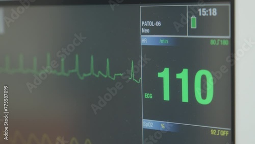 Heartbeat on hospital screen
