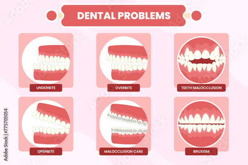 Dental Problems Illustration Collection