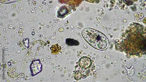 soil microorganisms including nematode, microarthropods, micro arthropod, tardigrade, and rotifers a soil sample, soil fungus and bacteria on a regenerative farm in compost under the microscope.	
