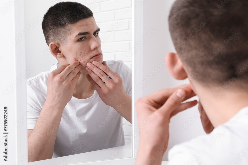 Upset young man looking at mirror and touching pimple on his face indoors. Acne problem Upset young man looking at mirror and touching pimple on his face indoors. Acne problem