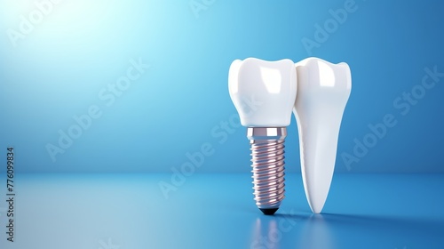 Realistic dental implant on a blue background 