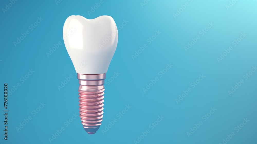 Realistic dental implant on a blue background Realistic dental implant on a blue background