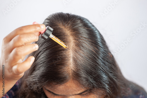 female using hair serum or minoxidil or hair oil for the treatment of hair fall or female pattern baldness