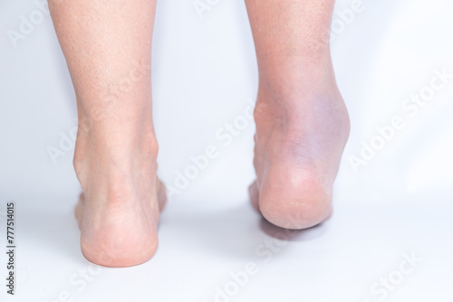 broken ankle, joint inflammation, pain, sprained foot, rehabilitation, accident