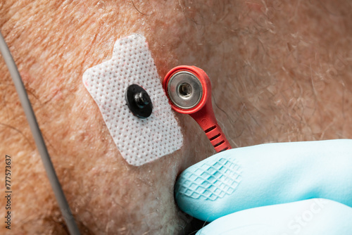 close up of attaching a red lead to an electrocardiography ECG EKG electrode for a heart monitor on an elderly Caucasian male patient