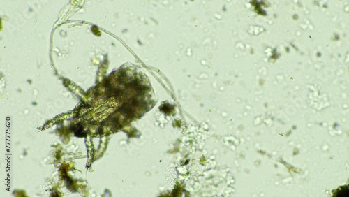 Soil microorganisms in a compost sample including bacteria, testate amoeba, flagellates. regenerative agricultural farm. Soil testing agriculture agronomy done for farmers for carbon sequestration photo