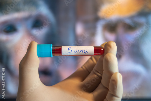 B Virus(herpes B, monkey B virus, Herpesvirus simiae,Herpes virus B,Macacine alphaherpesvirus 1)is the Simplexvirus infecting macaque monkeys. photo