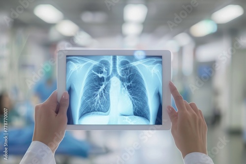 A medical professional analyzes a digital x-ray image of human lungs on a tablet in a clinical setting photo